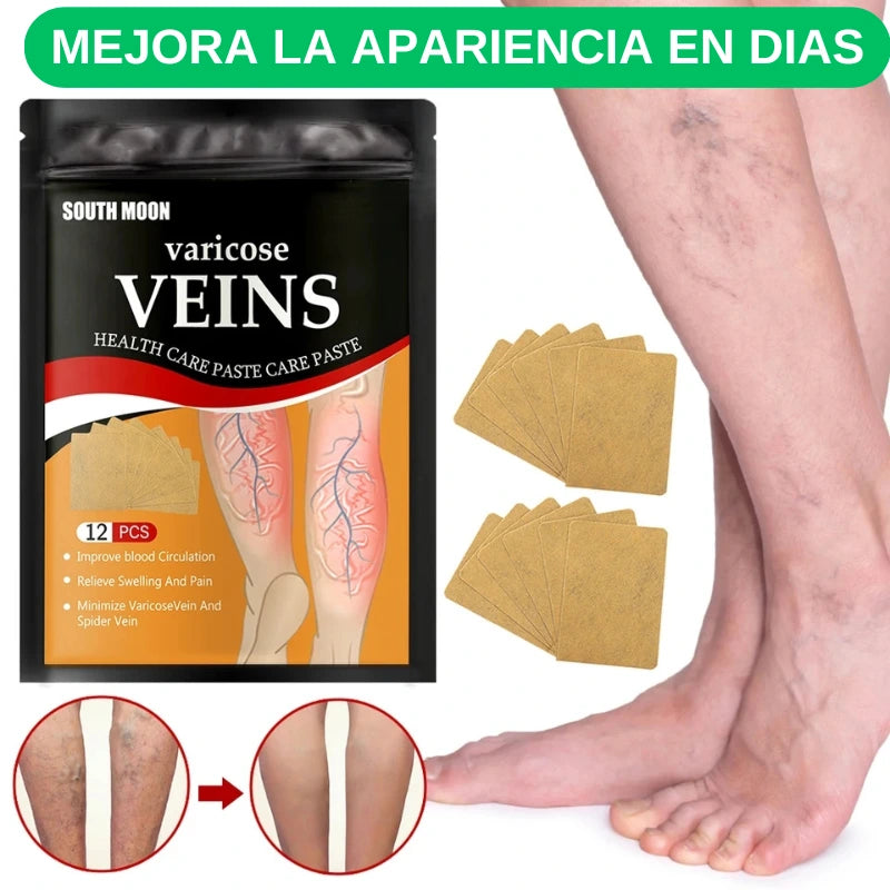 48 Parches para Varices -😊 Alivio para tus piernas cansadas